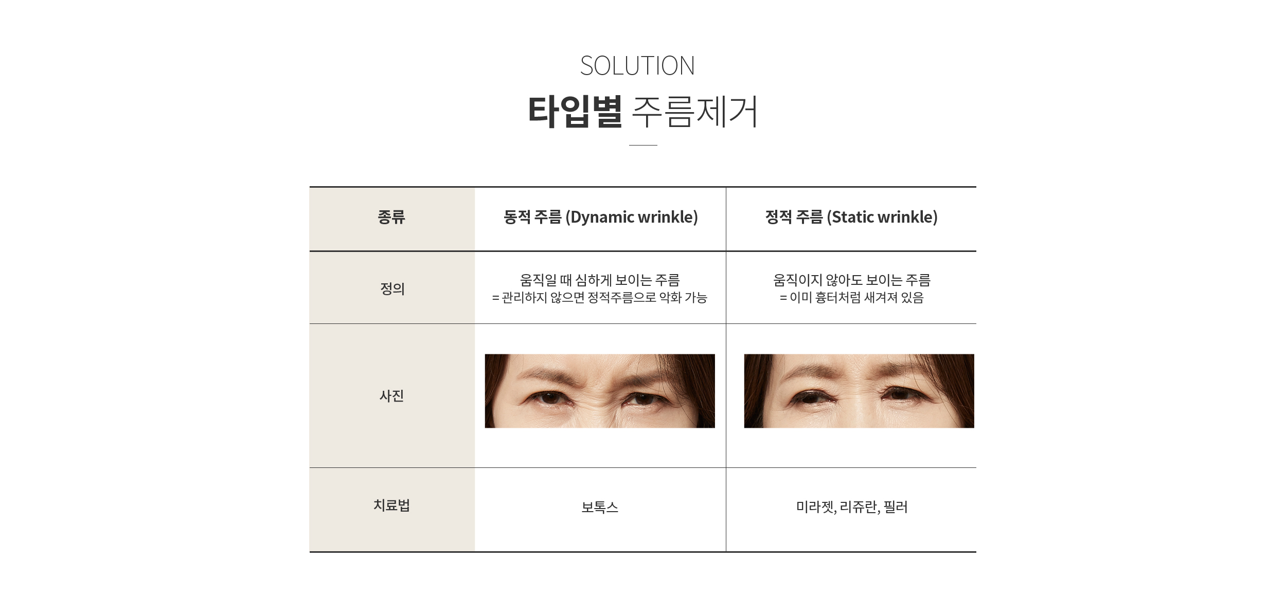 주름 타입별 제거시술