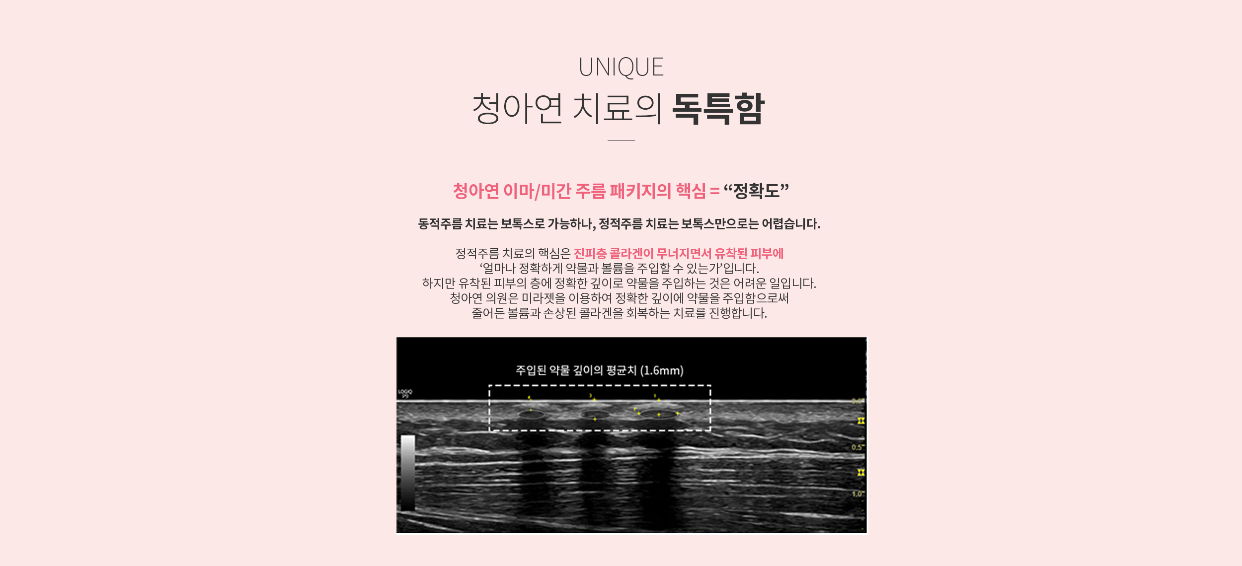 청아연 주름치료의 독특함