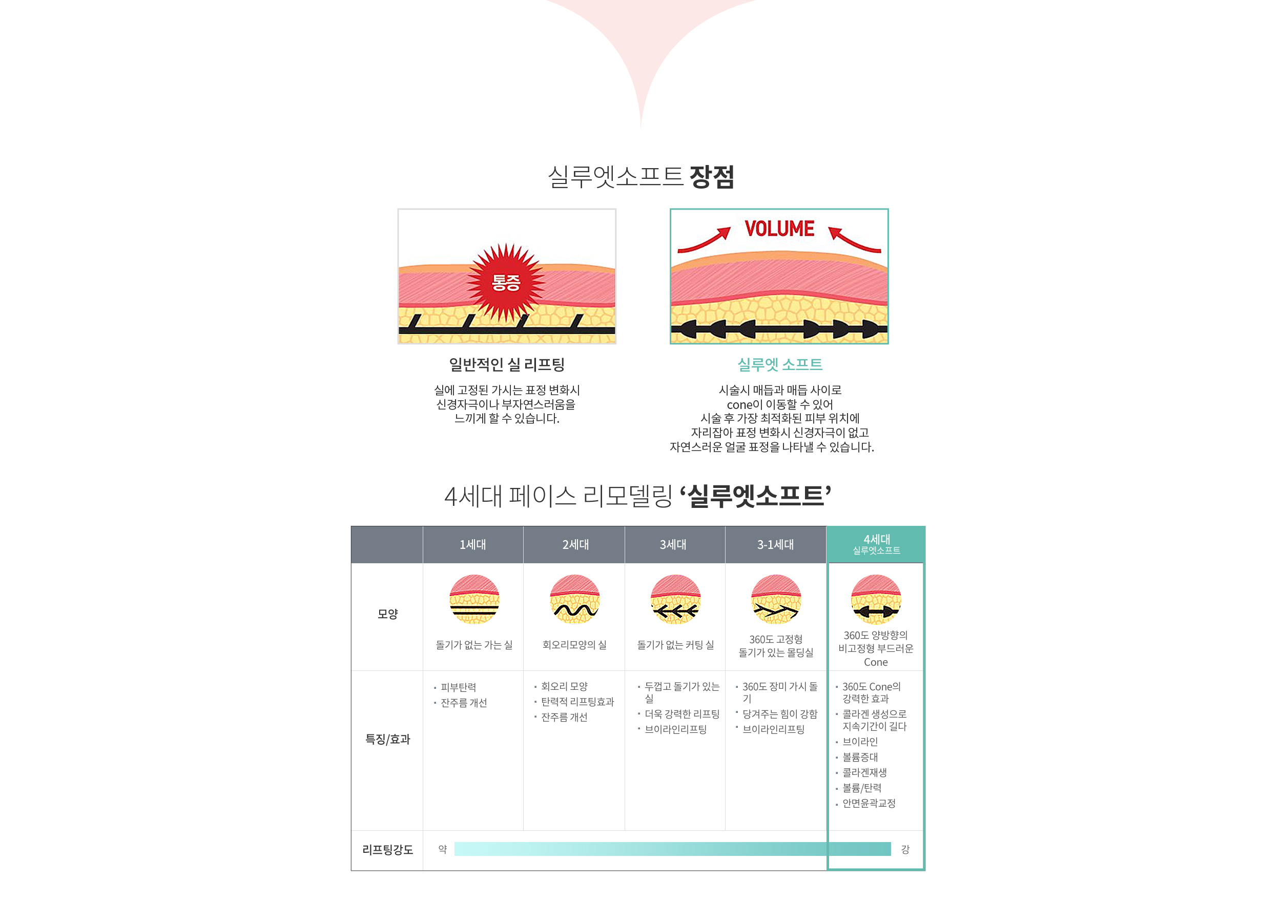 실루엣소프트 장점 / 4세대 페이스 리모델링