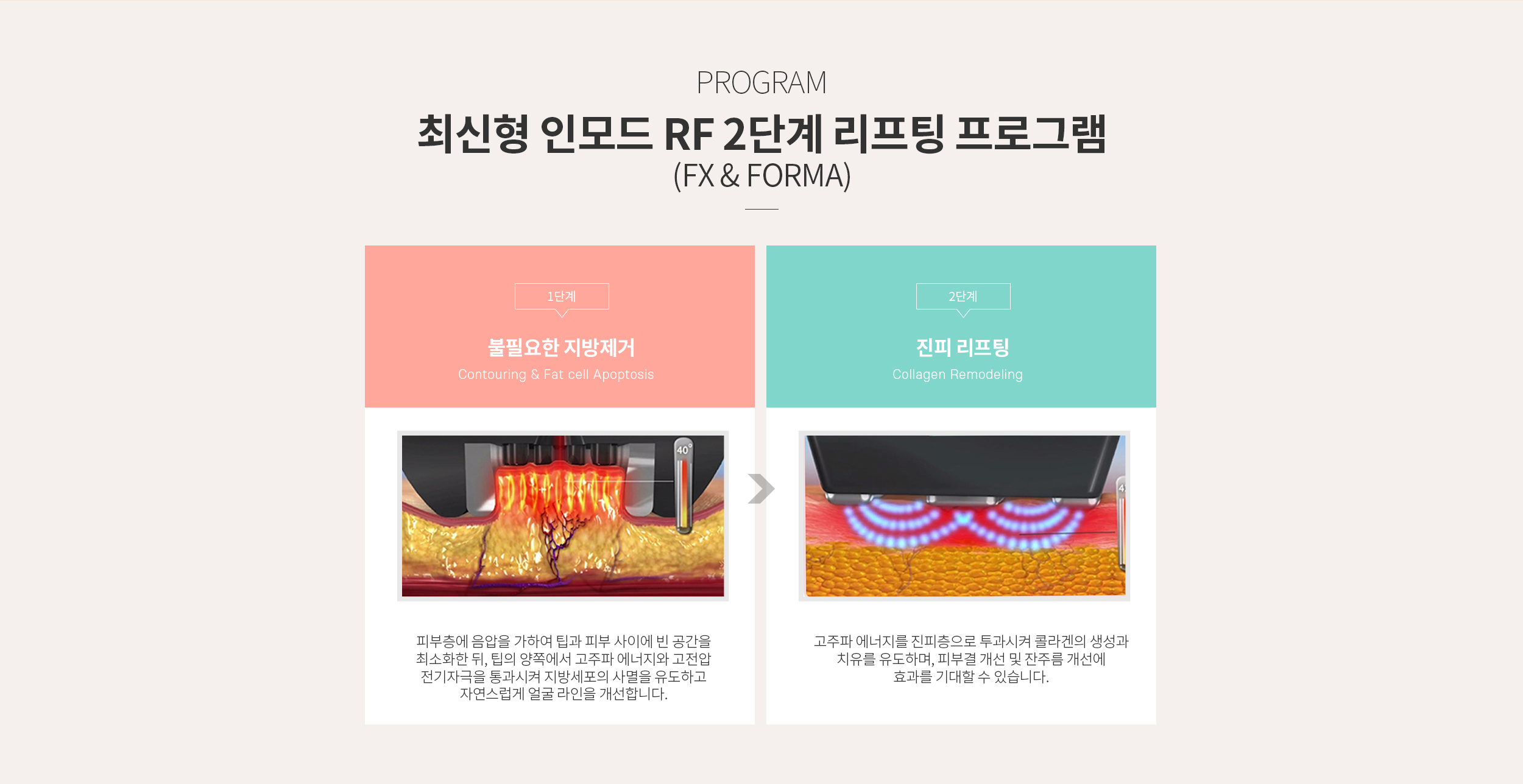 최신형 인모드 RF 2단계 리프팅 프로그램