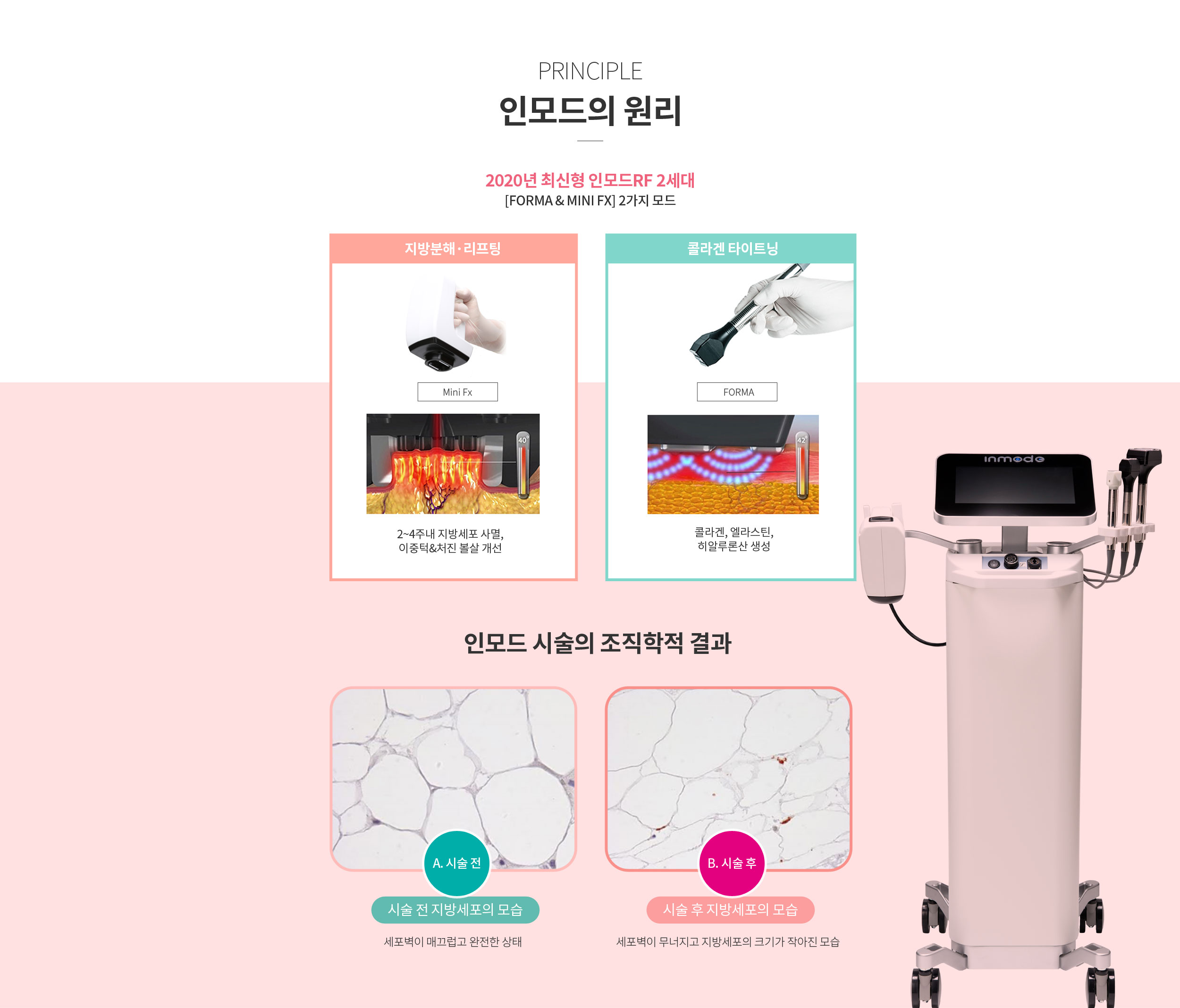 인모드의 원리
