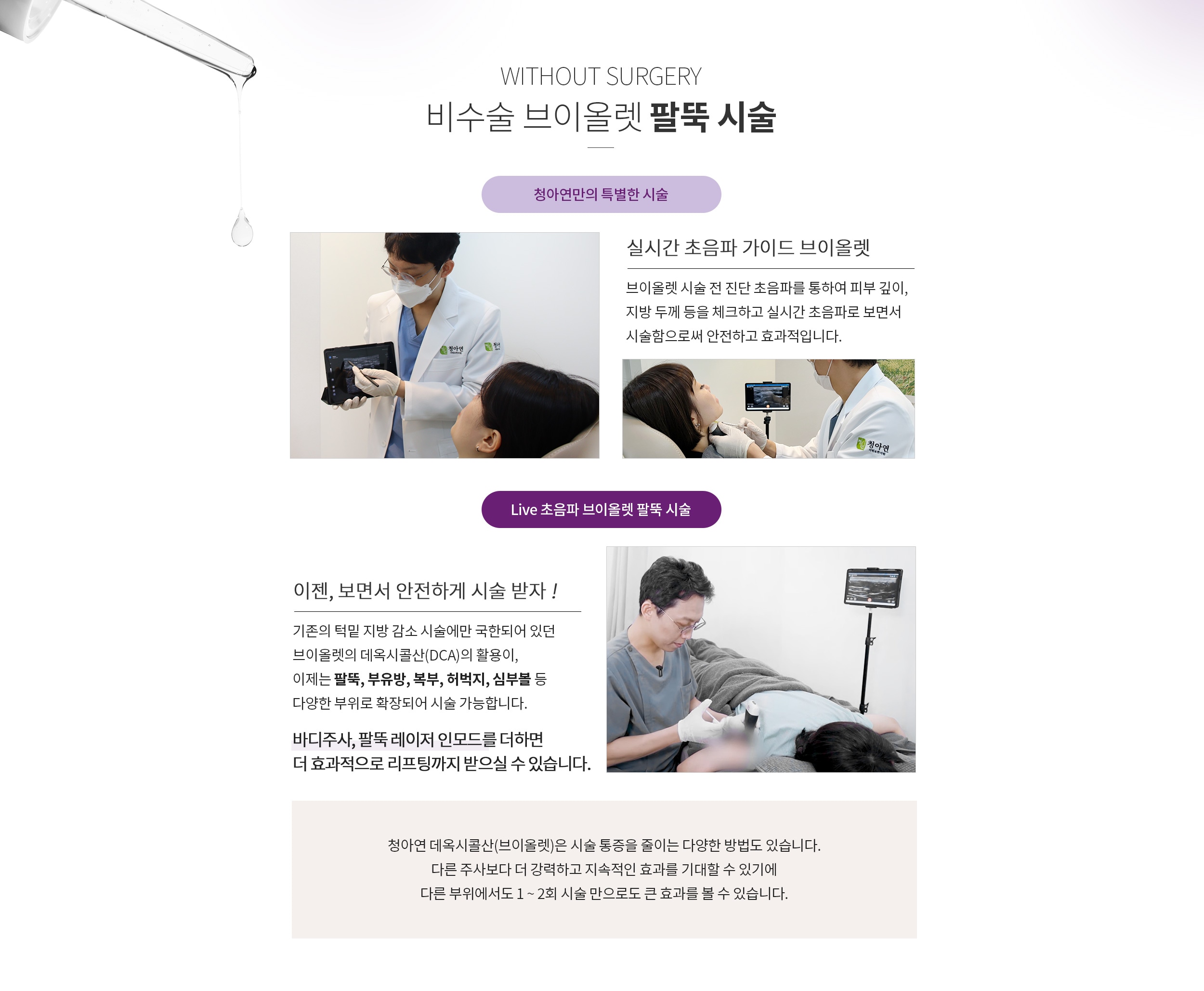 브이올렛 팔뚝 시술