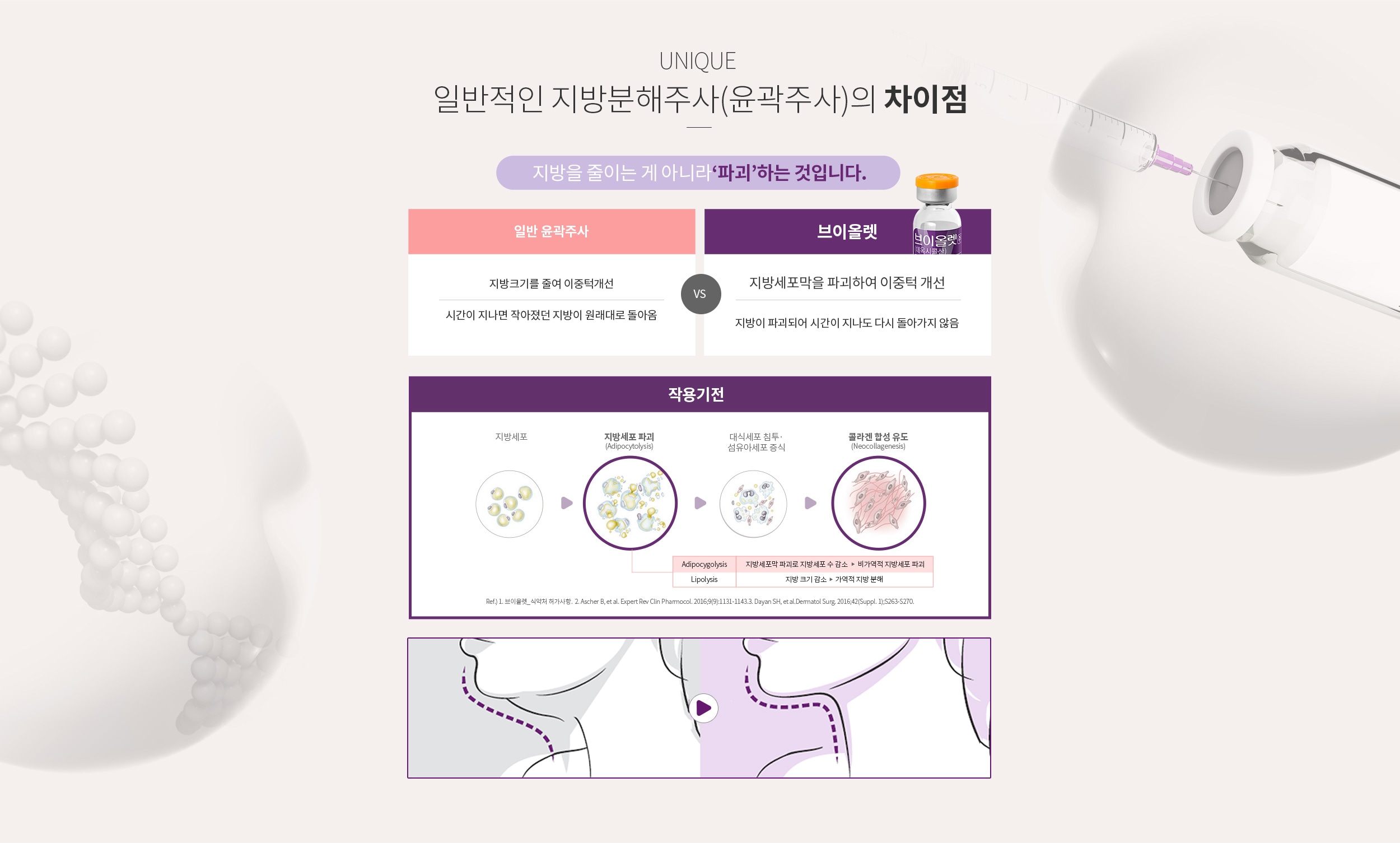 지방분해주사(윤곽주사)와의 차이점