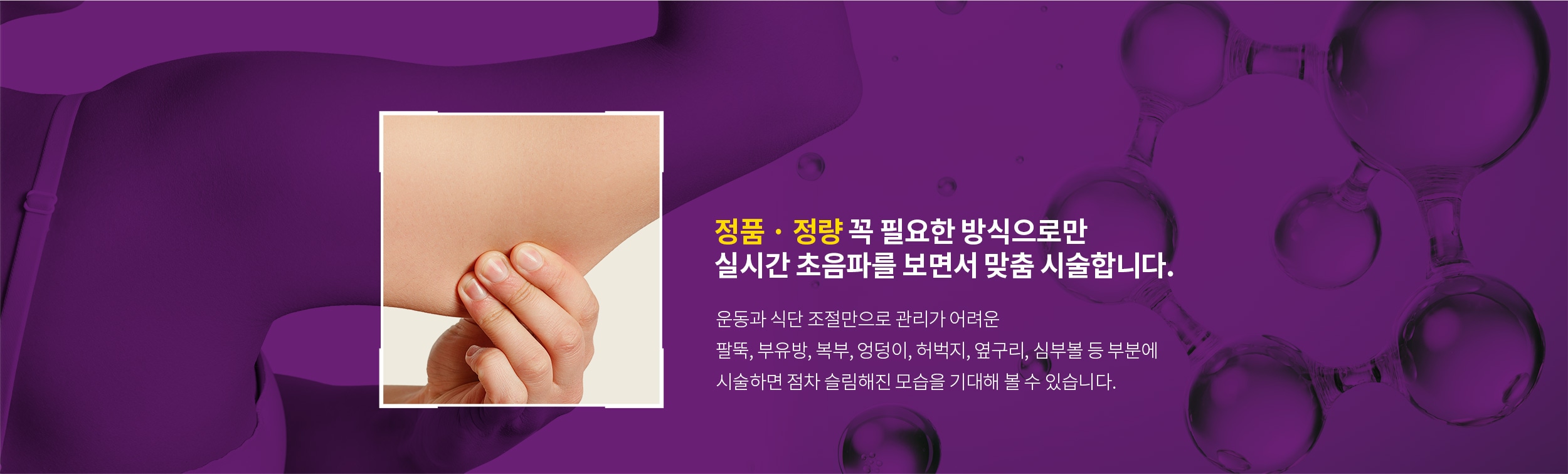 정품 정량 실시간 초음파 시술