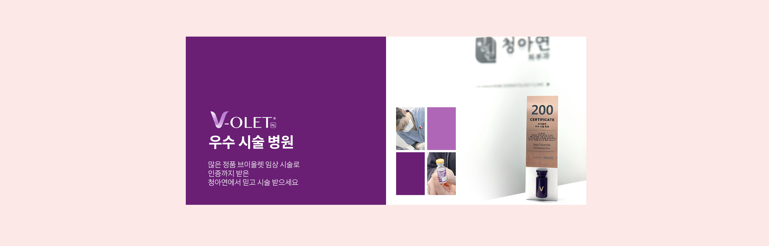 정품인증 브이올렛 우수시술 병원