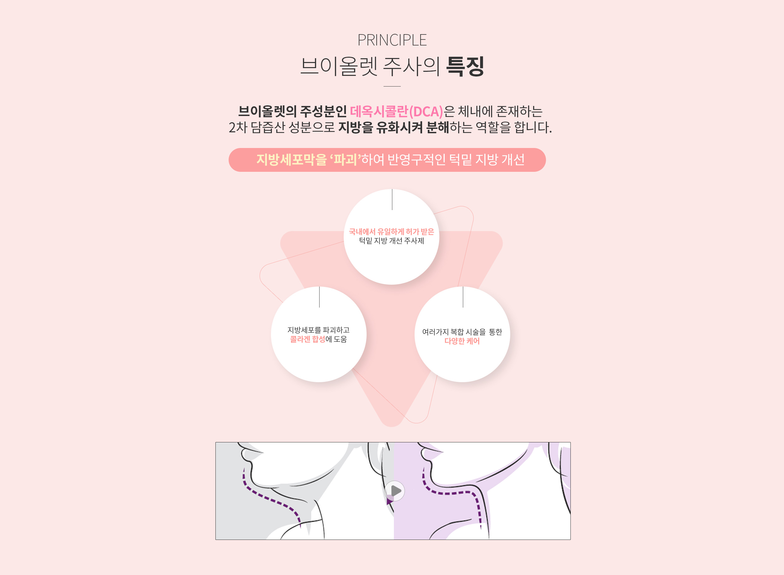 브이올렛 주사의 특징