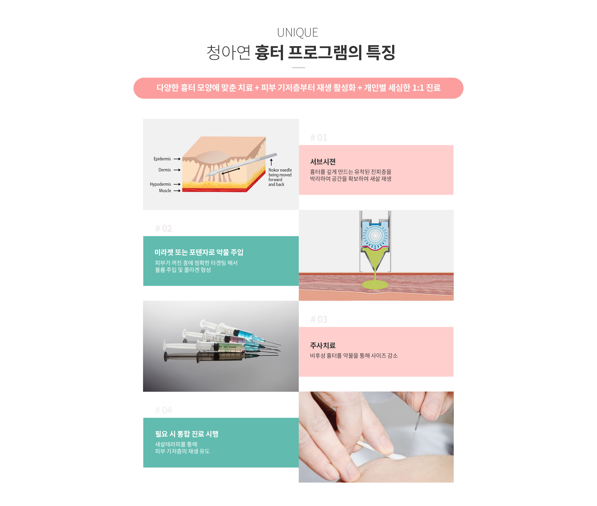 청아연 흉터 프로그램의 특징 및 치료법