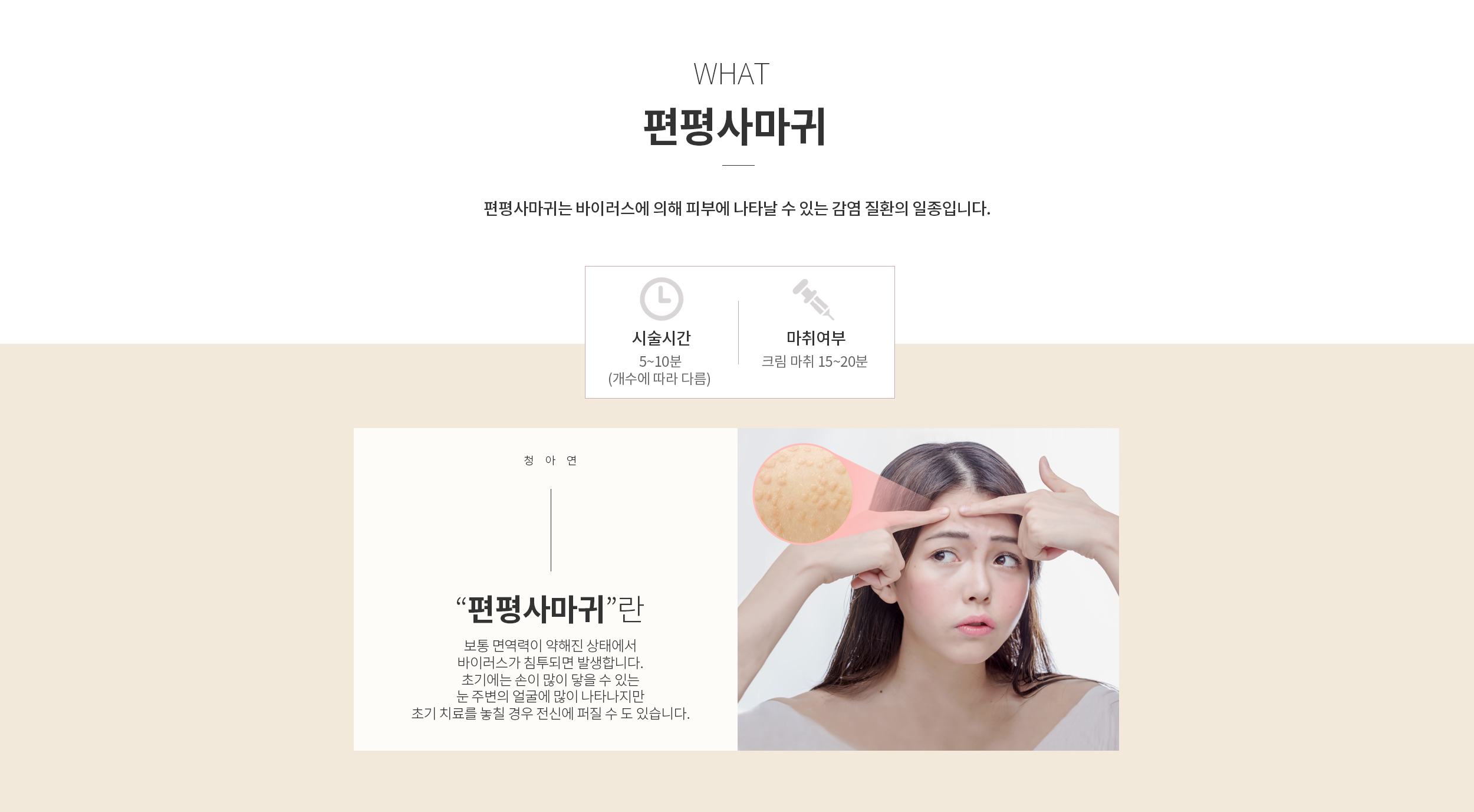 편평사마귀란?