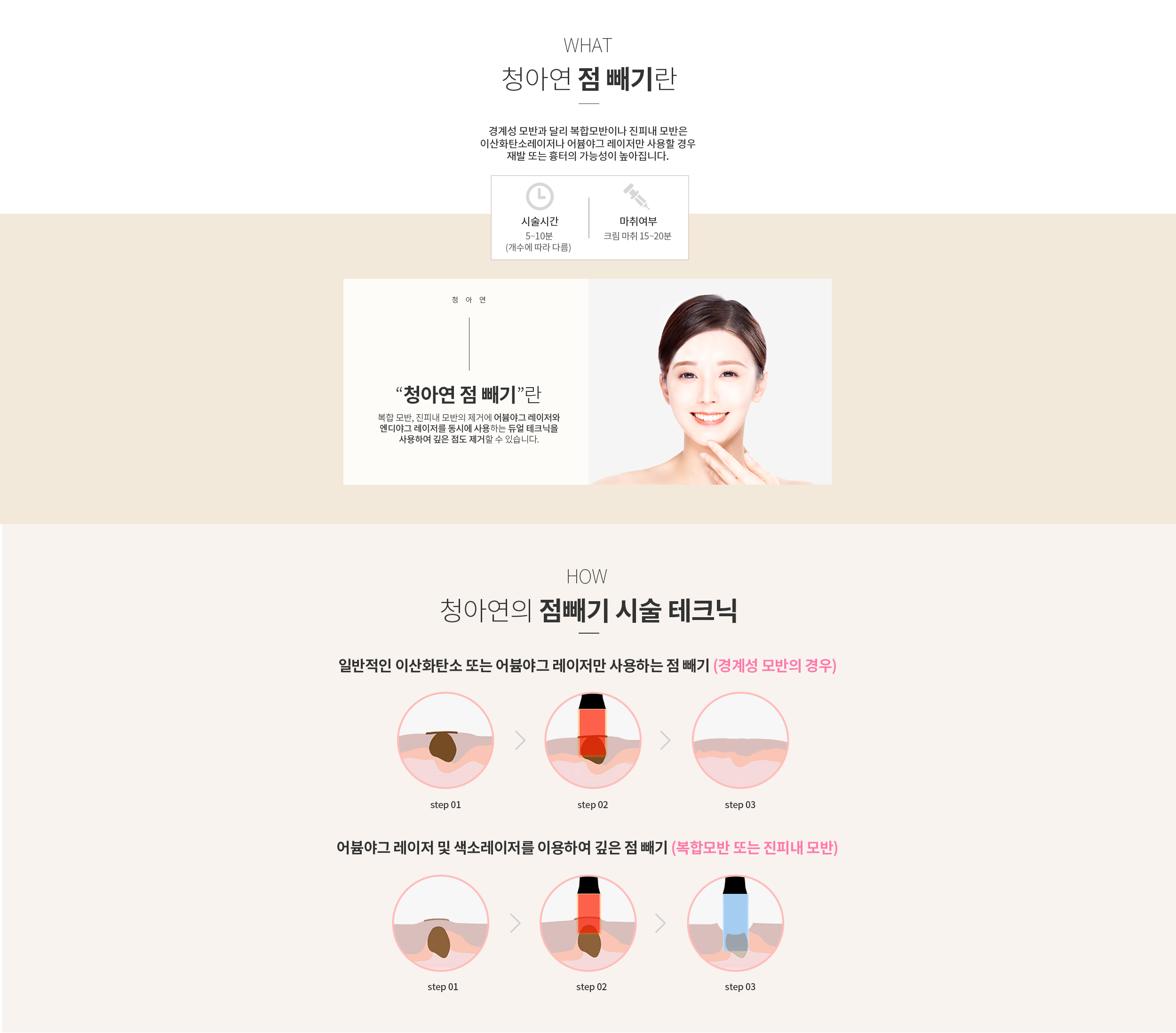 청아연 점 빼기란? / 시술 테크닉