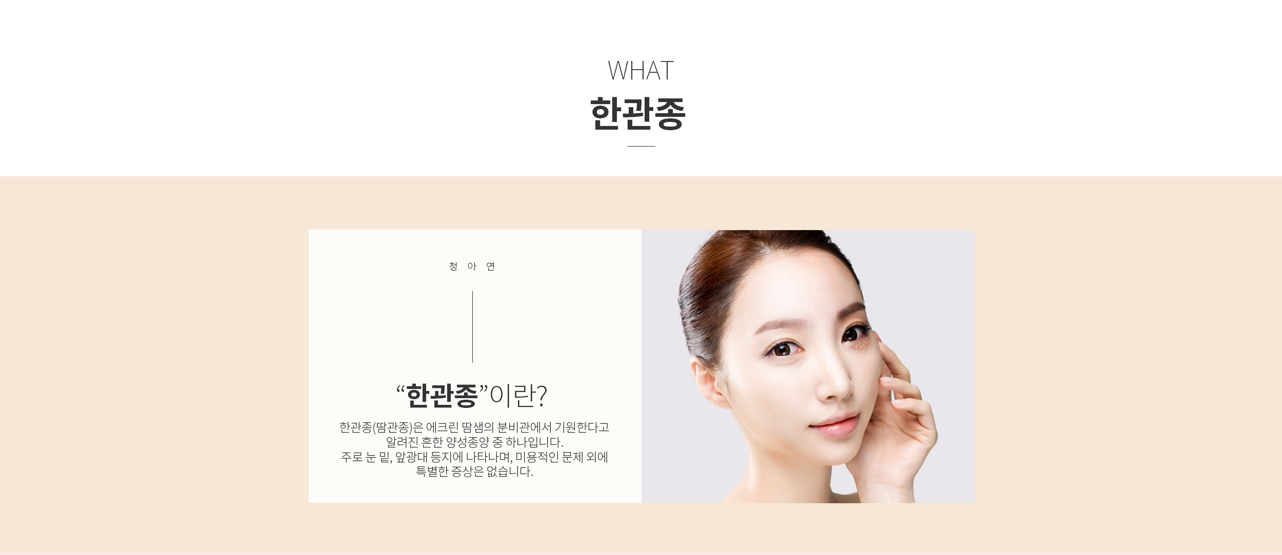 한관종이란?