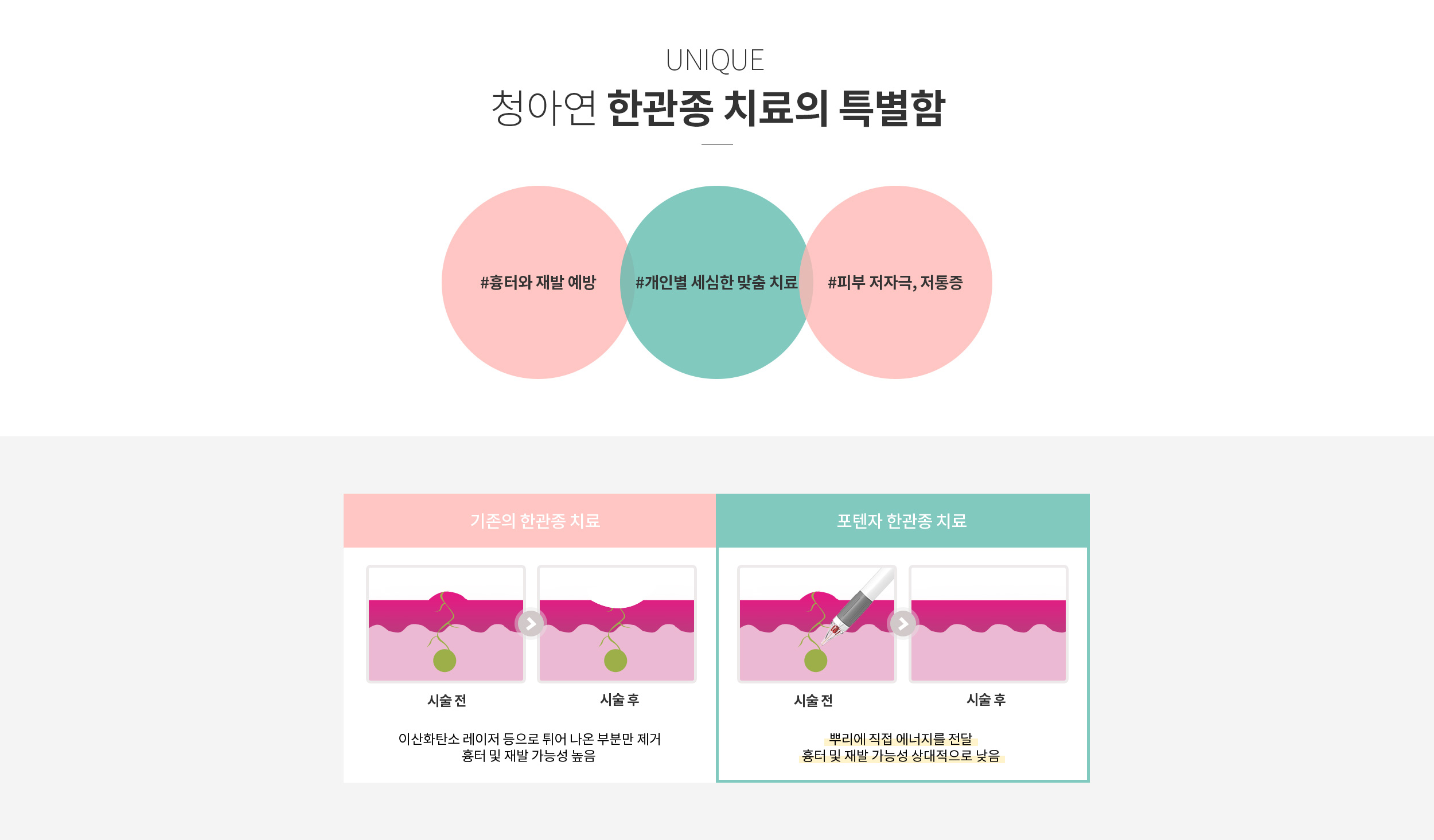청아연 한관종 치료의 특별함