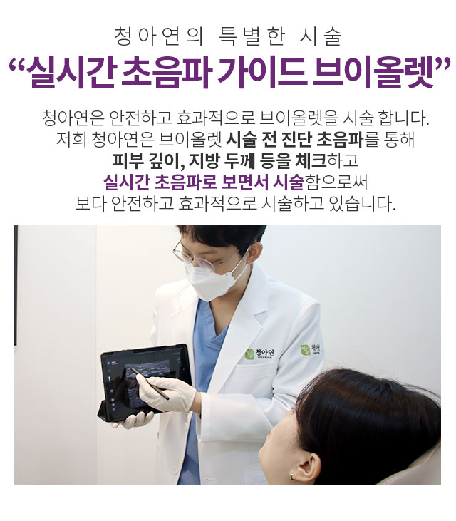 초음파 가이드 브이올렛