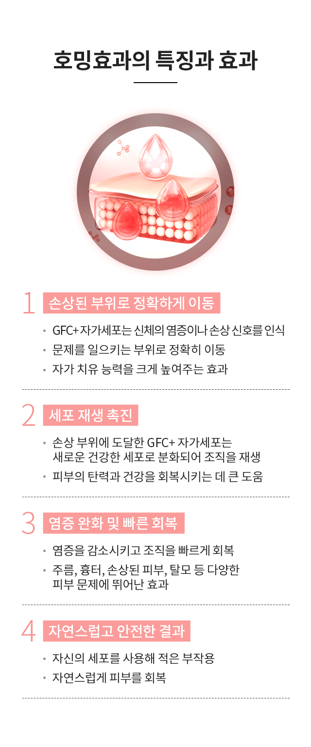 줄기세포 호밍효과의 특징와 효과