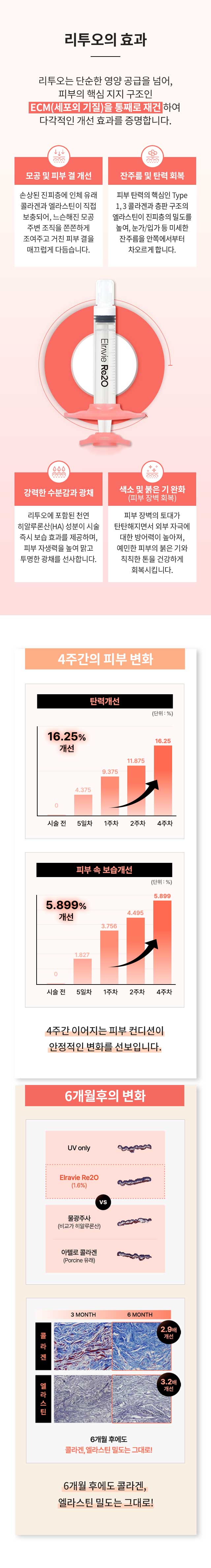 ?섎씪鍮꾩뿉 由ы닾?ㅼ쓽 ?④낵 : 由ы닾?ㅻ뒗 ?⑥닚???곸뼇 怨듦툒???섏뼱, ?쇰????듭떖 吏吏 援ъ“??ECM(?명룷??湲곗쭏)???듭㎏濡??ш굔?섏뿬 ?ㅺ컖?곸씤 媛쒖꽑 ?④낵瑜?利앸챸?⑸땲??
