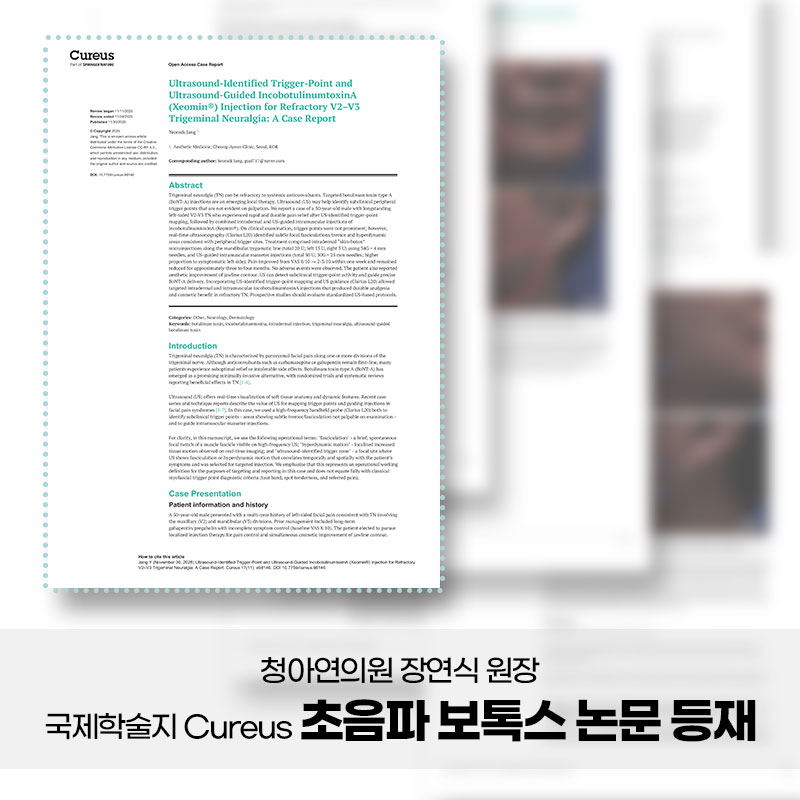 청아연의원 장연식 원장, ,국제학술지 Cureus 초음파 보톡스 논문 등재