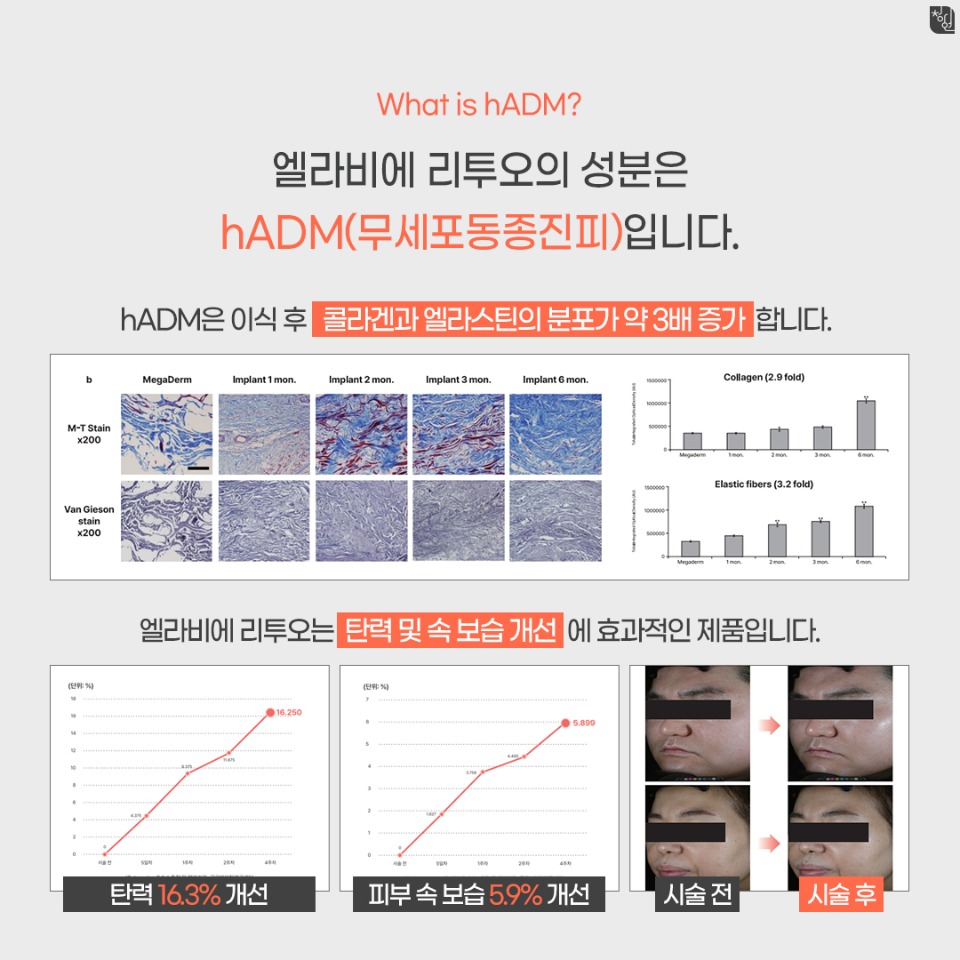 리투오3.jpg