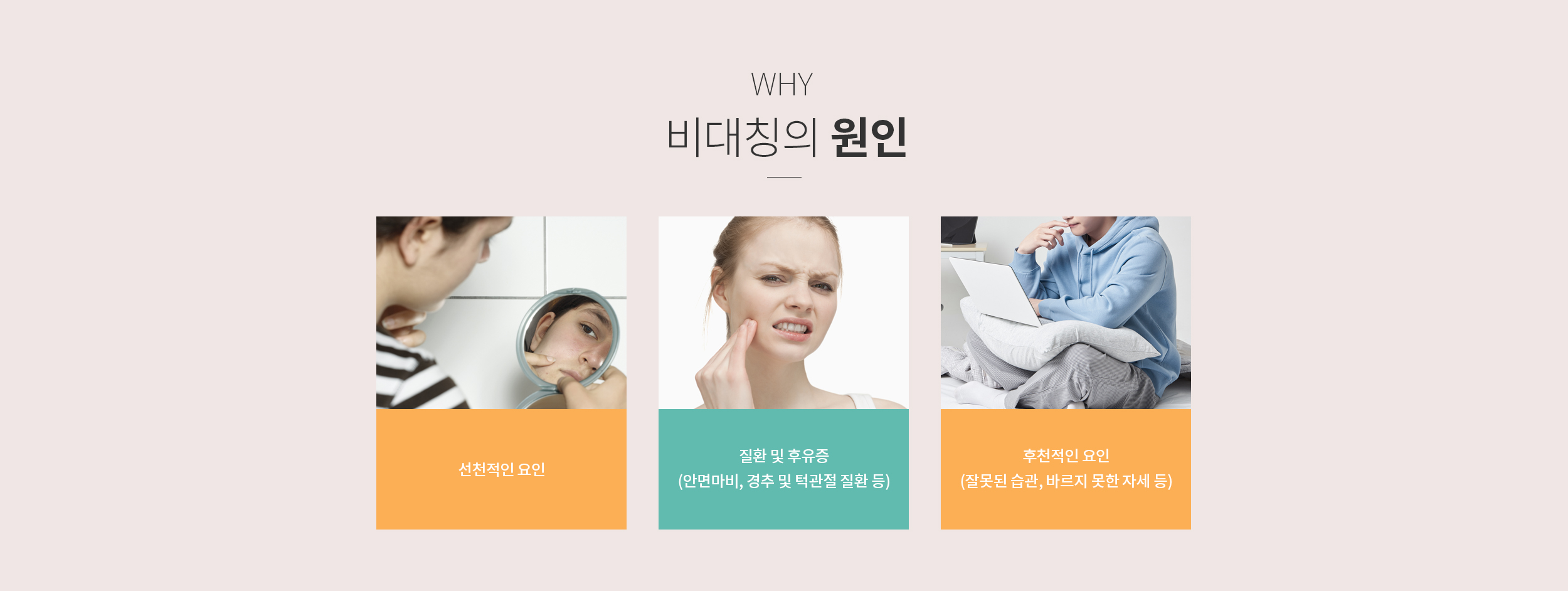 비대칭의 원인