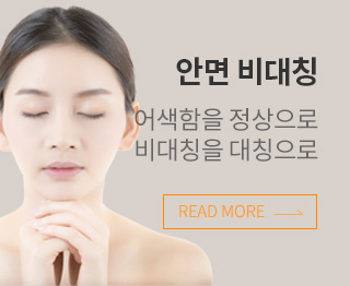 안면비대칭