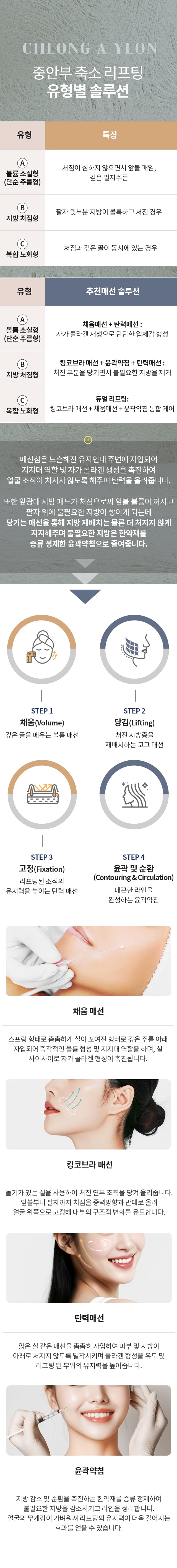 중안부 축소 리프팅 유형별 솔루션