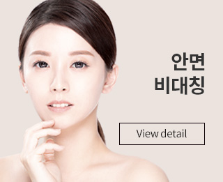 안면비대칭